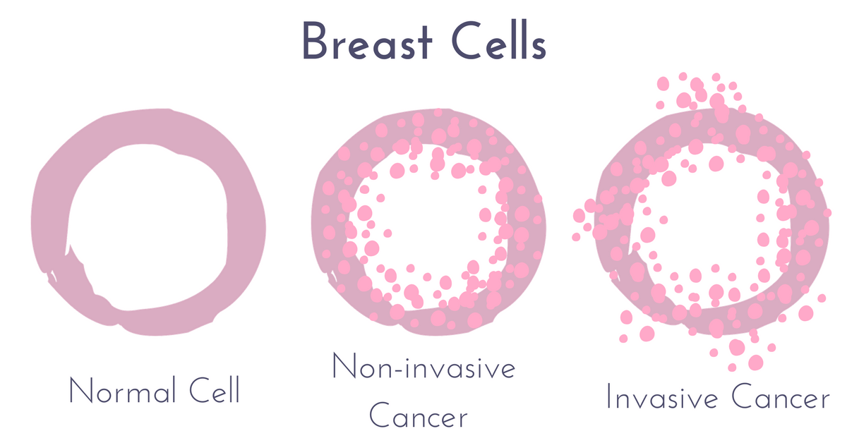 what does invasive mean in breast cancer what does invasive mean in breast cancer